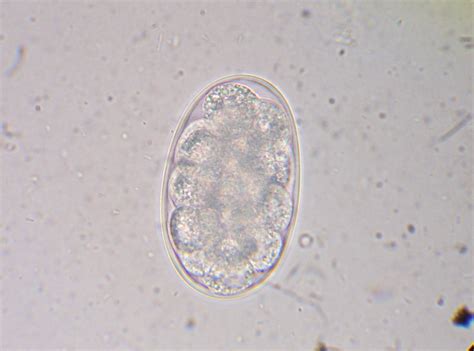 Human Hookworm