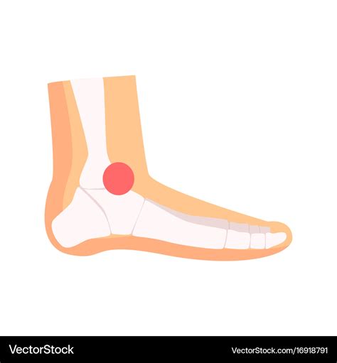 Ankle joint pain cartoon Royalty Free Vector Image