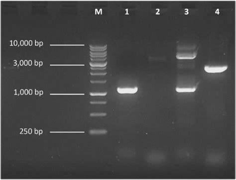 Pcr Analysis The Agarose Gel Electrophoresis From Dna Of The Strains ...