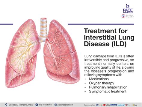 Interstitial Lung Disease - Causes, Symptoms and Treatment