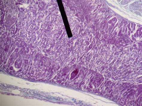 Adrenal medulla - wikidoc