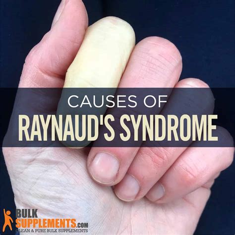 Raynaud's Syndrome: Symptoms, Causes & Treatment