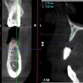 Preoperative view of both the maxilla and mandible. | Download Scientific Diagram