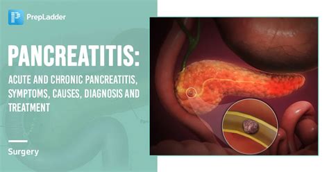 Pancreatitis: Acute And Chronic Pancreatitis