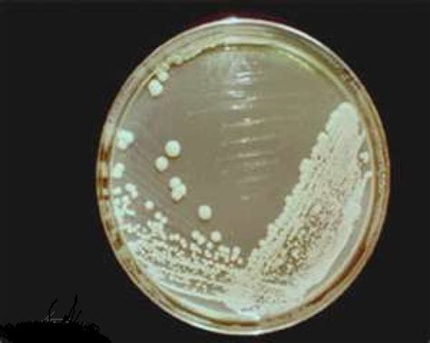 Yeast (Saccharomyces cerevisiae) » BioTek