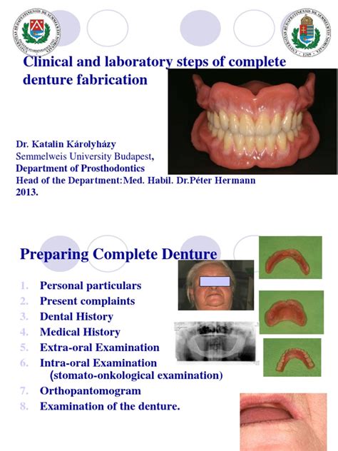 Clinical and Laboratory Steps of Complete Denture | Dentures | Dentistry