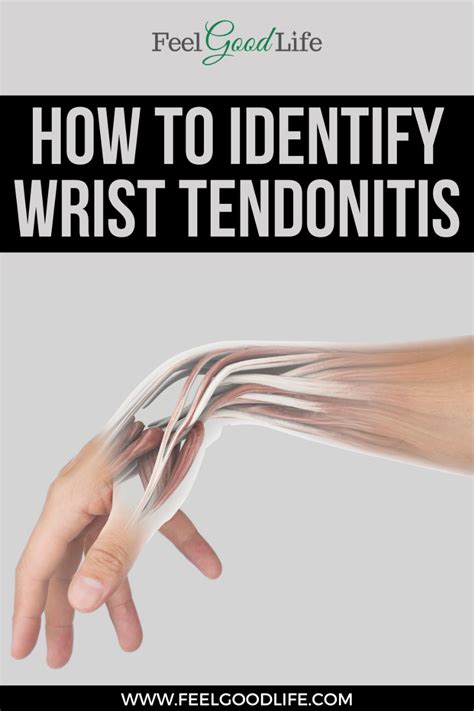 Best exercises for wrist tendonitis to help your pain diminish – Artofit