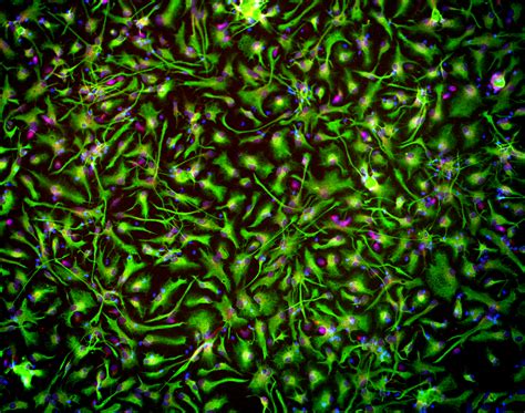 Cortical Astrocytes — BrainXell