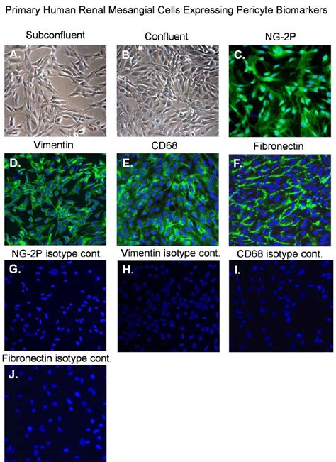 Normal mesangial cells expressing pericyte biomarkers Phase contrast... | Download Scientific ...