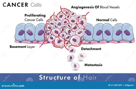 Cancer Cell Development Entire Mechanism Including Angiogenesis ...