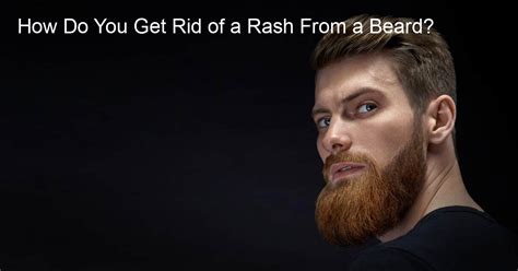 How Do You Get Rid of a Rash From a Beard? - The Beard Style