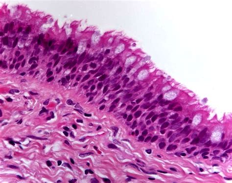 Difference Between Epithelial and Endothelial Cells | Definition, Characteristics, Function