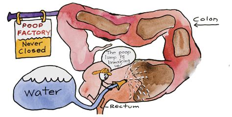 Cartoon - What-is-colon-hydrotherapy - Trust In The Process