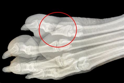 X Ray Broken Toe