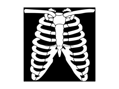 X Ray Clipart Black And White