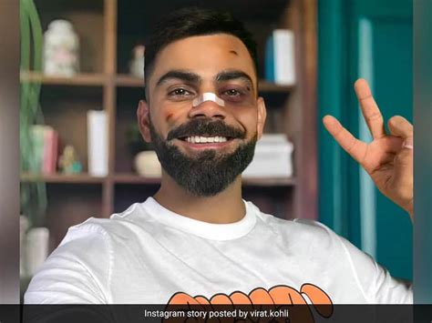 Fans Left Bemused After Virat Kohli Shares 'Beaten Up' Instagram Story ...