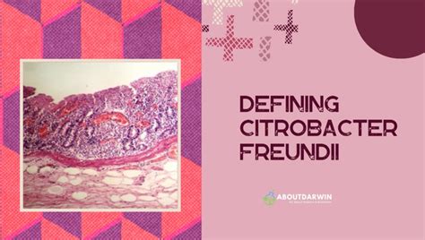 Citrobacter Freundii: Biochemical Tests & Identification