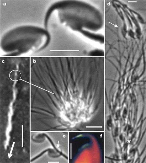 Development of sperm train.a, Phase-contrast image of spermatozoa after... | Download Scientific ...