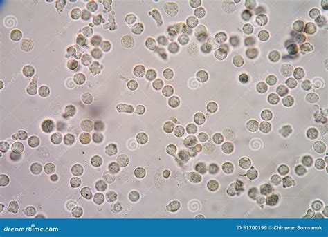 White Blood Cells Of A Human, Photomicrograph Panorama As Seen U Stock Photo - Image: 51700199