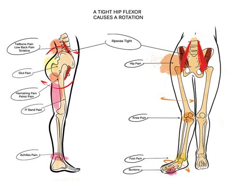 Tight Hip Flexor Physical Therapy - Christine Koth - Holistic PT