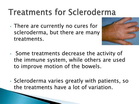 PPT - Scleroderma PowerPoint Presentation, free download - ID:2583575