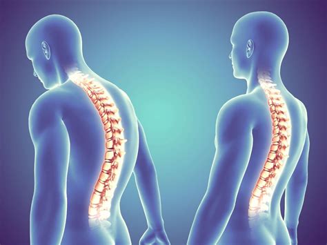 Common Spine Conditions: Insights from Orthopedic Experts | Best Orthopaedic Hospital in Mumbai ...