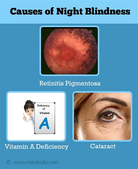 Night Blindness - Causes, Symptoms, Diagnosis, Treatment & Prevention