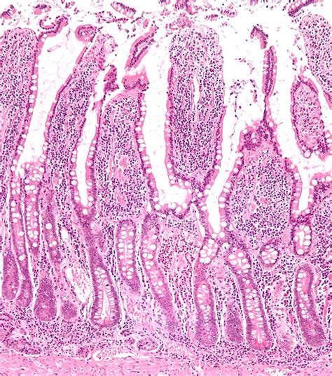 What is the Difference Between Villi and Microvilli - Pediaa.Com