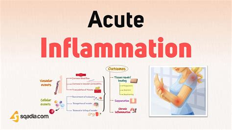 Acute Inflammation