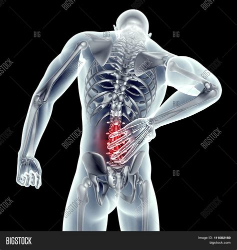 X-ray Image Man Back Image & Photo (Free Trial) | Bigstock