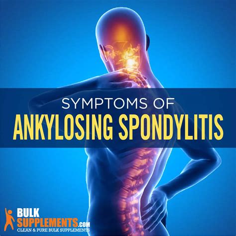 Ankylosing Spondylitis Symptoms, Causes and Treatments