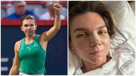 Simona Halep Undergoes Nose Surgery; Rendered Unable To Play Until 2023