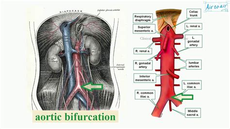 aortic bifurcation - YouTube