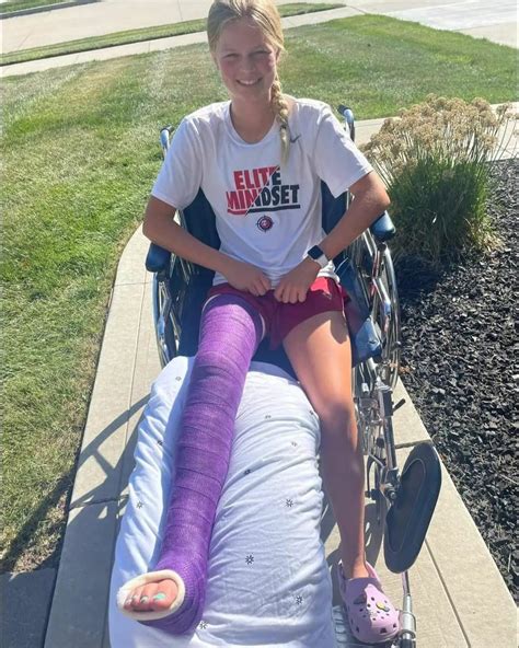 Beth is out for the season again, but seems really happy with big purple cast.