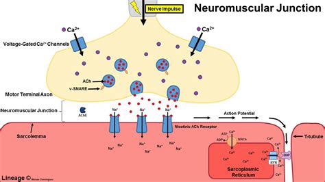 Lambert-Eaton Syndrome - Neurology - Medbullets Step 1