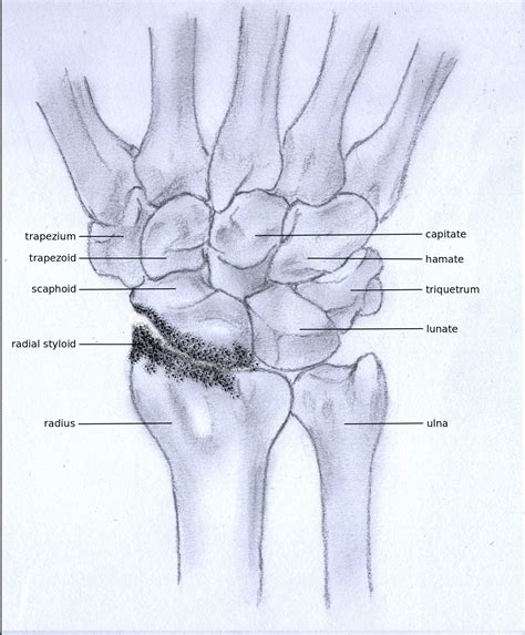 Wrist Joint; Radiocarpal Joint