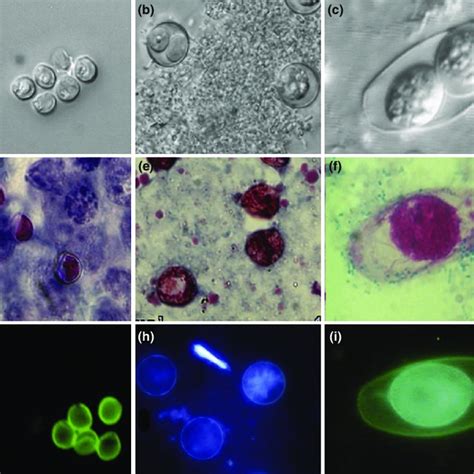 Life cycle of Cystoisospora belli. Reproduced from... | Download Scientific Diagram