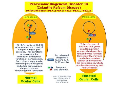 Peroxisome Biogenesis Disorder 3B (Infantile Refsum Disease ...