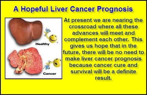 1000+ images about Liver Cancer Life Expectancy on Pinterest