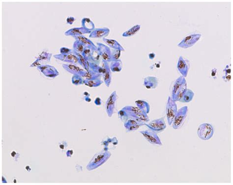 Giemsa-stained culture of gametocytes on day 15 after both Nycoprep and ...