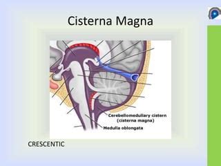 Cisterna Magna Anatomy