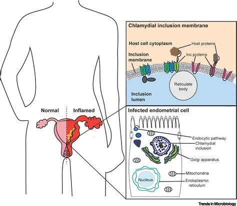 Chlamydia trachomatis: Trends in Microbiology