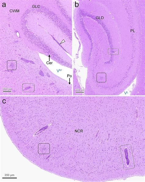 Encephalitic pattern in rustrela virus (RusV)-infected cats Histology ...