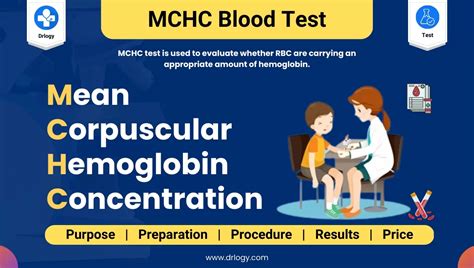 What is the normal range for MCHC?