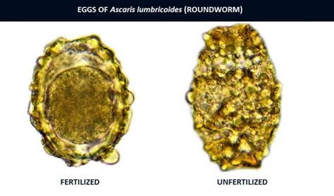 Ascaris lumbricoides (Roundworm) Eggs: Morphology, Characteristics and Identification