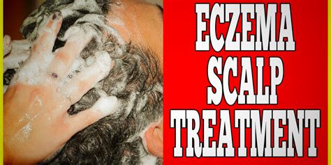 Eczema Scalp Treatment - Clinton Conley