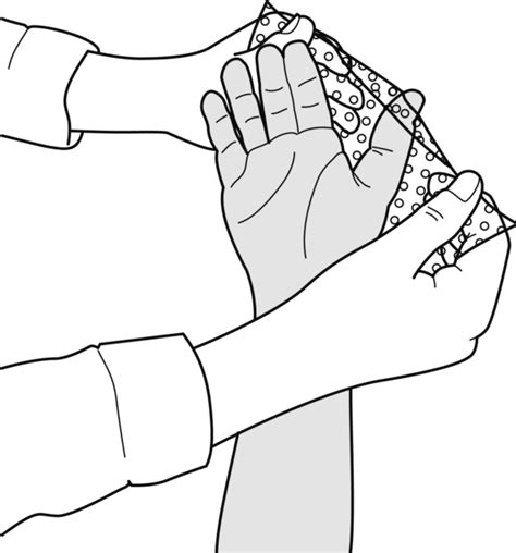 Guide MCP arthroplasty splint