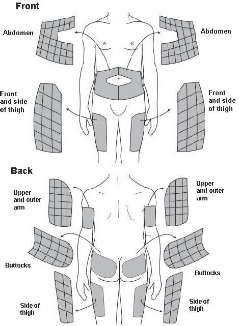 Printable Insulin Injection Site Rotation Chart