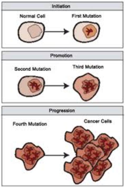 Cancer Stages With Staging Chart - HubPages