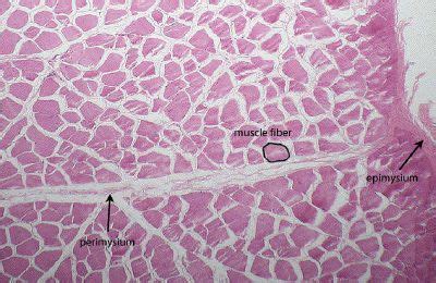 Histology: Skeletal Muscle Within a fascicle - you can see the muscle ...